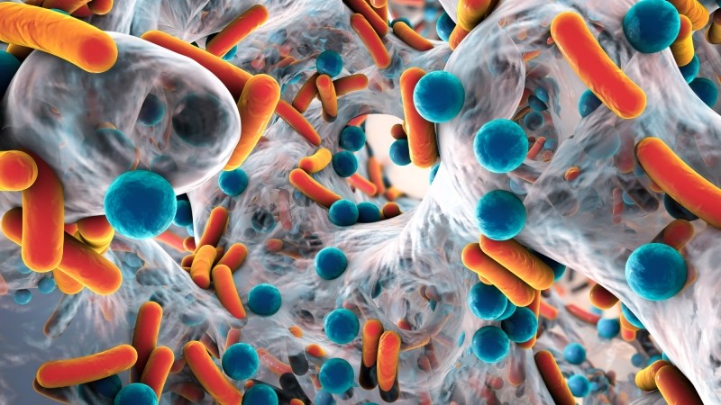 Antimicrobial resistance (AMR)