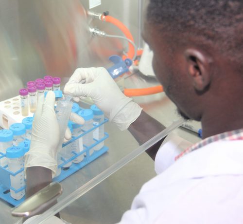 The Bacteriology Department aims to improve the quality of life first for Ghanaians and the world at large by conducting research into bacterial diseases of public health importance to Ghana and globally.   In addition to working on enteric pathogens and sexually transmitted diseases, the department’s current main focus is on the two most important mycobacterial diseases of public health importance to Ghana, namely Buruli ulcer (BU) and tuberculosis (TB).  The department in collaboration with other research partners is contributing to the global fight against TB and BU by conducting studies that aim to contribute to the control of these diseases by improving understanding of disease epidemiology, genetic diversity within the causative agent, host-pathogen interactions and laboratory diagnosis.  In order to make our research findings beneficial for disease control, we work closely with endemic communities and these field activities are carried out in close collaboration with the respective national control programmes and district health management team of the Ghana Health Service.  Our work involves collection/receiving of pathological samples, bacteriological culture and conventional characterisation as well as genomic diversity analysis.  Within our TB research, we have established active DNA fingerprinting, using methods such as spoligotyping, MIRU/VNTR, RD and SNP, analysis as well as mutational analysis in drug target genes.  Thus our laboratory serves as reference laboratories for both TB and BU, and also gives us the capacity to be involved in the evaluation of effectiveness of interventions such as diagnostics and vaccines.  The Department in its role as the National TB Reference Laboratory is involved in the organization and maintenance of the National TB Laboratory Network, development of training manuals and organization of laboratory training and implementation of nationwide TB laboratory Quality Assurance, and anti-TB drug resistance surveillance.  Since 2013 we  have been actively involved in Yaws research activities through collaborative research with the Centers for Diseases Control and Prevention (CDC, Atlanta), the World Health Organization (WHO), the Ghana National Yaws Eradication Program and the Ghana Health Service with support from the Spanish NGO, Anesvad Foundation.